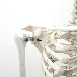 Calcium deficiency for bariatric surgery patients – Celebrate Vitamins
